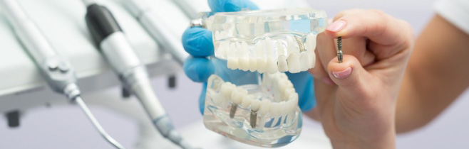 Tratamiento estetica dental