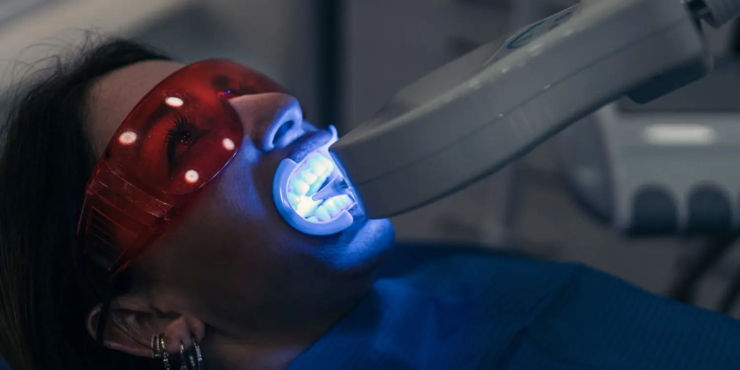 ¿Qué tipos de blanqueamiento dental existen?