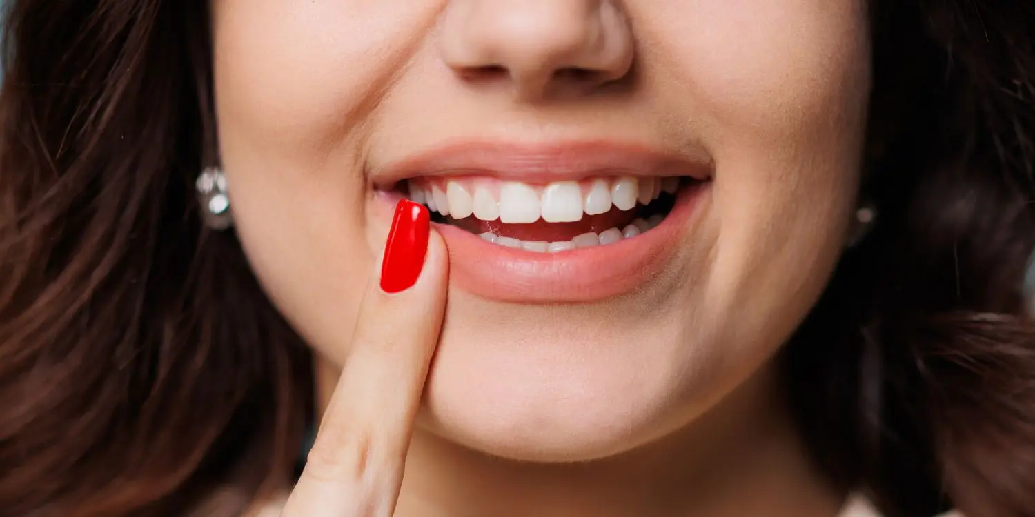 ¿Duele un blanqueamiento dental?