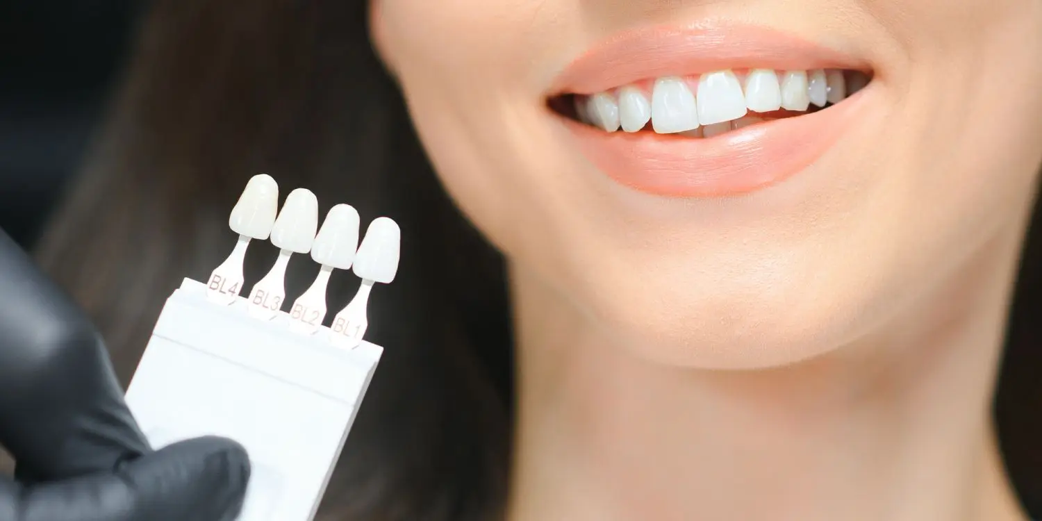 ¿El blanqueamienot dental es malo para los dientes?