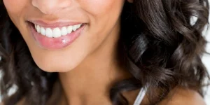 ¿Cada cuánto hacer un blanqueamiento dental?