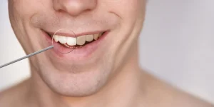 ¿Por qué tengo los dientes marrones de repente?
