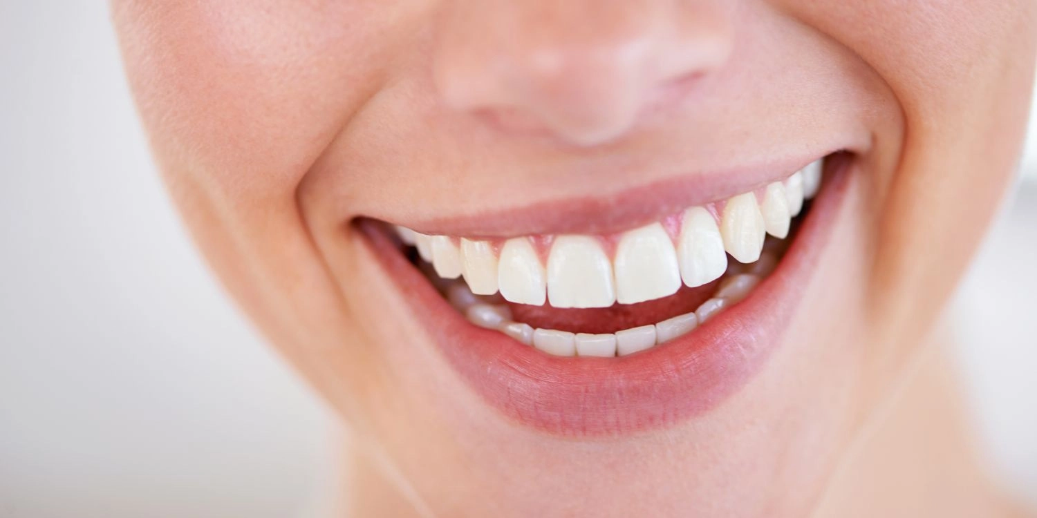 Cómo mejorar la sonrisa sin ortodoncia