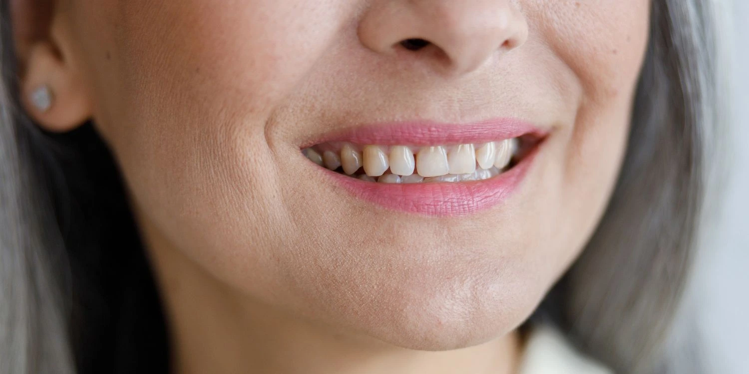 El esmalte dental desgastado: causas y prevención