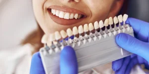 Qué hacer si no me gusta el color de mis dientes