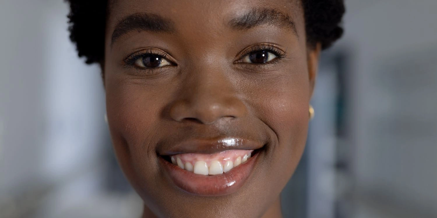 Sonrisa gingival: qué es y cómo se corrige