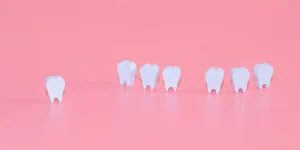 ¿Por qué se mueven los dientes? Causas y Soluciones.