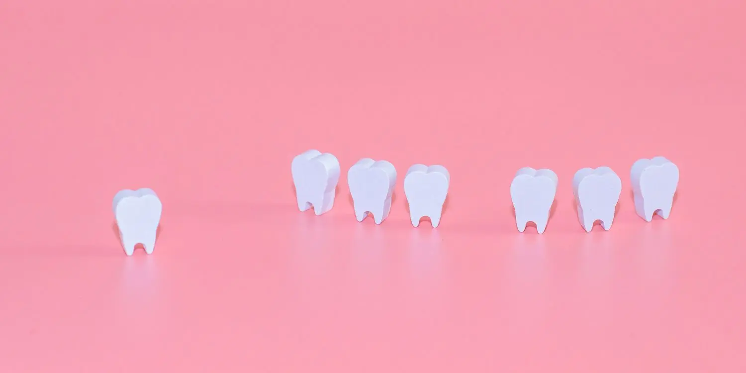 ¿Por qué se mueven los dientes? Causas y Soluciones.