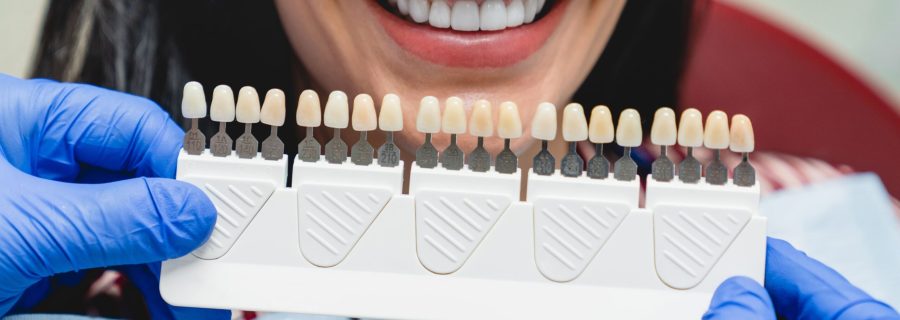 carillas-dentales carillas-dentales